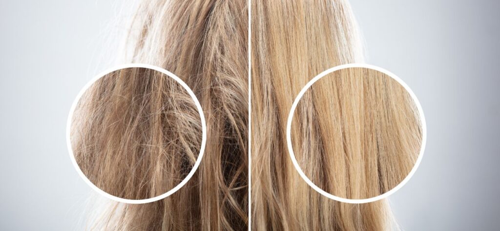 suplementacja na włosy, skórę i paznokcie, włosing, porost