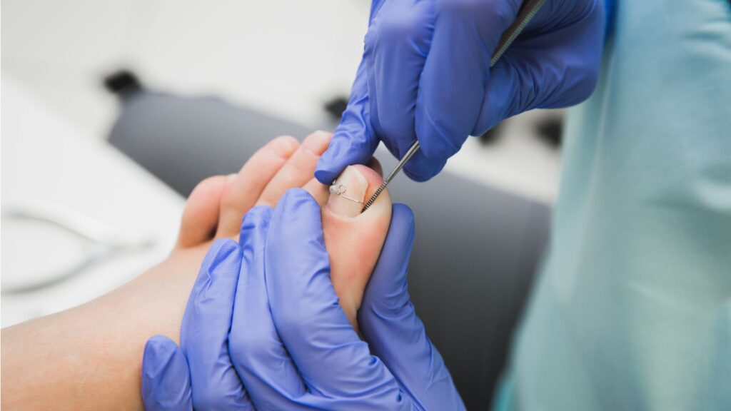 jak dbac o stopy i kiedy wybrać się do podologa