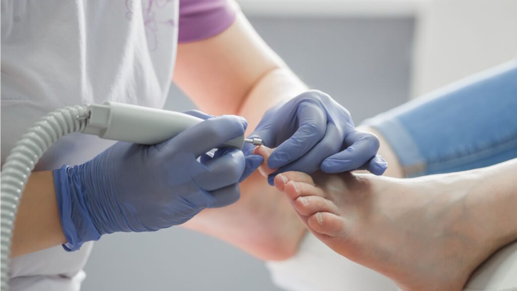 kiedy wybrać się do podologa?