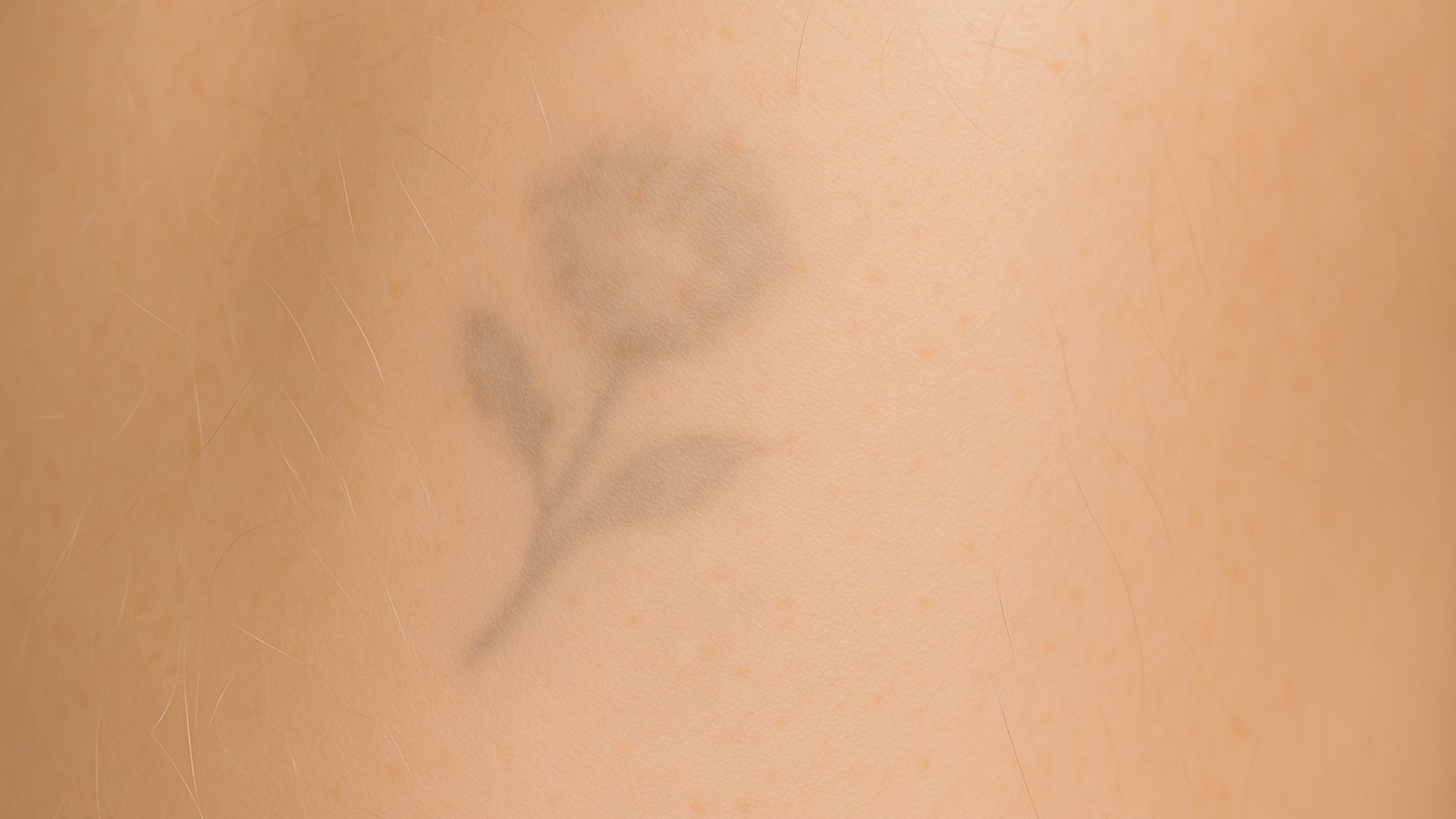 usuwanie tatuażu laser